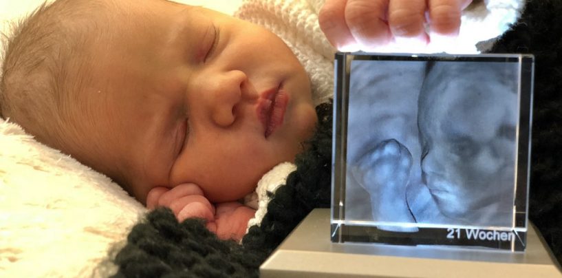 Vorgeburtliche Babybilder so real und greifbar wie noch nie