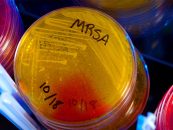 Kampf gegen resistente Bakterien: Forscher arbeiten an neuartigen Wirkstoffen