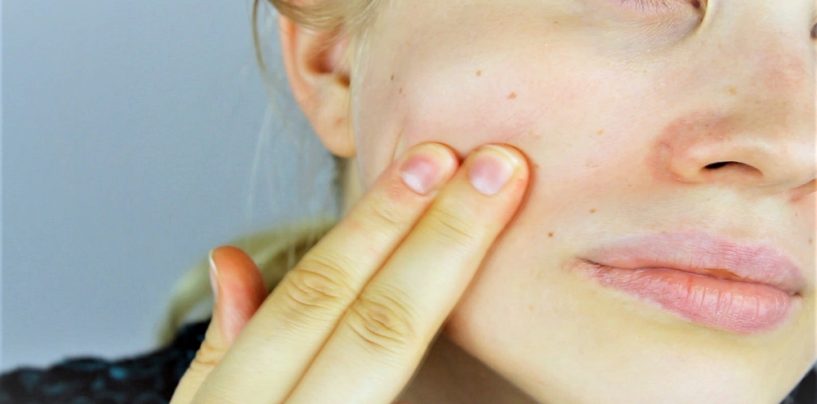 Das Hautbild verbessern: Diese Tipps können helfen
